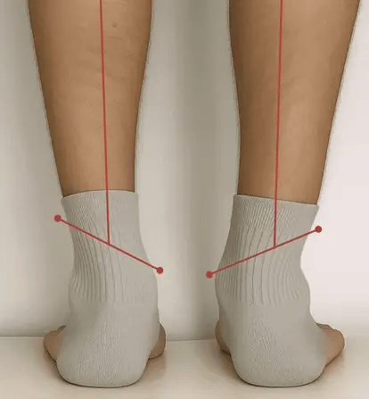 Soolara™ Tabanlık